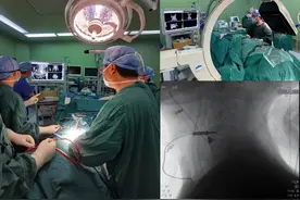 全国首例！四川大学华西医院骨科成功完成在光磁一体手术导航系统辅助下的颈椎前路手术图片