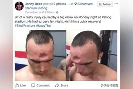 一肘下去干碎头骨？搏击比赛严禁肘击，胳膊肘的威力到底有多强？图片