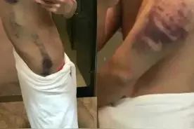 “出门就把你卖了”缅北归来，口述恐怖遭遇图片