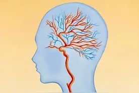 “脑供血不足”的人，脸上或有5个迹象，希望你能放在心上图片