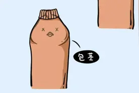 包茎问题从小就要处理吗？包茎手术什么时候做合适？图片