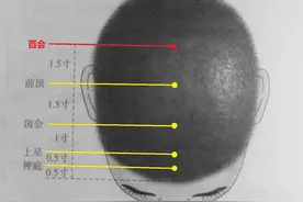 百会穴的妙用图片