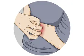 身上的阴虱是怎么来的？感染后有啥感觉？刮阴毛好，还是不刮好？图片