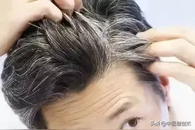 治疗白发血虚肾亏的八款中成药，让你恢复满头乌发，重返年轻图片