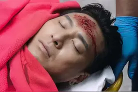 TVB男星黄子恒沦为男N号，多次在剧中领盒饭，割完双眼皮变帅哥图片