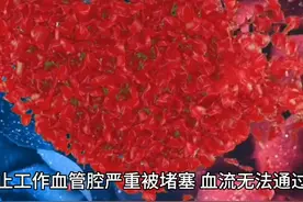 在生命最后时刻 各器官最后一次对话图片