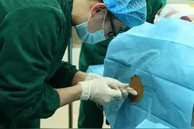 手术中，她突然感觉脸上发麻、两眼一黑就过去了，醒来已是两天后图片