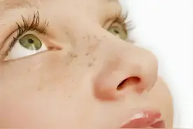 为什么你脸上的斑总是“春风吹又生”？图片