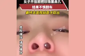 女子往鼻孔塞珍珠，喷气砸头都无法取出，最终赴医院求助，当事人：当时看到小孩鼻子里卡黄豆感觉不信邪图片