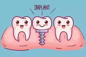 种植牙降价！但关于种植牙的这些，你要知道...图片