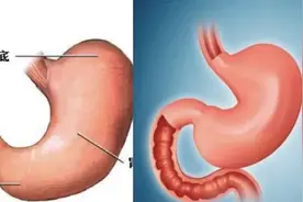 胃！你好吗？图片