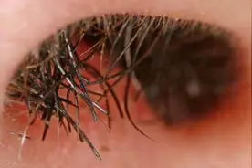 “鼻毛变白”是衰老的前兆吗？或许有其他原因，建议男性要留意图片