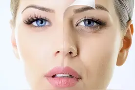 除皱项目你真的知道怎么选择吗？图片