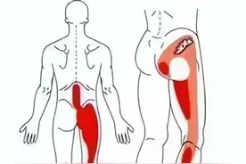 为啥臀部、小腿后外侧酸胀痛、麻木？千万不要忽略这4种问题图片