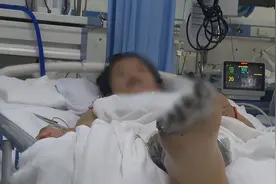 揪心！女孩充电时玩手机“被电击”，内脏受损面临截肢！图片