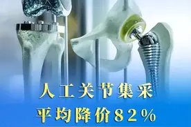 【特别关注】降价了！成都人工关节“采”入千元区！图片