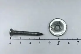 新手装修工人被钢钉射穿眼球，扎进颅内4公分，医生脑中“拔钉”图片