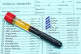 公务员体检被刷，让人猝不及防，怎么才能有备无患？图片