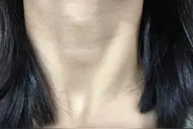 今天看了一个喉结的女生，我给大家普及一下图片