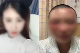 抓住黄金15秒，从浓硫酸魔爪下拯救你的脸图片