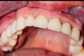 让黑黄牙变白的方式很多种，最不伤牙的竟是这种图片