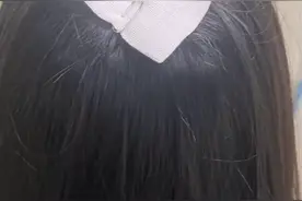 女子理发店漂染致头皮流脓脱发，被诊断为二级烧伤，店家回应：操作没问题烧伤或因个人体质，会沟通协商赔偿图片