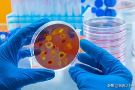 地球上12种最致命的病毒图片