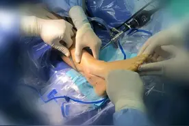 崴脚怎么办图片