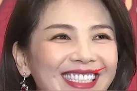 明星“烤瓷牙”有多可怕？嘴凸显老，嘴包不住牙，演戏都没法看了图片