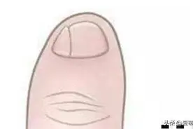 观点：小脚趾裂开两瓣指甲，不是纯正的汉族人？是鲜卑族后代？图片