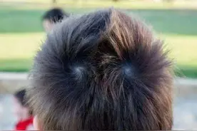 孩子头上的旋为何不同图片