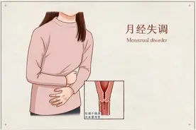 月经是女性健康的“晴雨表”！月经不调？中医来帮忙图片