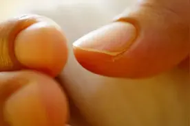 从指甲就能看出肺癌？是真的，但没那么简单图片