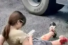 女子脚被大货车压没，却能淡定地支撑、打电话，令人佩服！图片