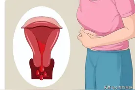 女性来例假时，突然流出一股血块，是身上的肉吗？图片