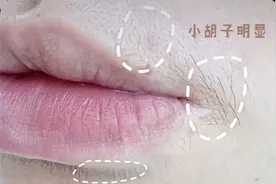 为什么女生也会长“小胡子”？图片