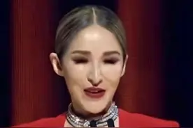 鼻尖脸僵下巴歪，“科技与狠活”成就的盛世美颜，保质期有多短？图片