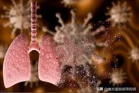 肺炎是由什么引起的？肺炎需要住院吗？科普：肺炎图片