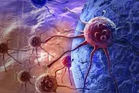 体内有恶性肿瘤的人，身体通常会有7个表现，平时要注意观察图片