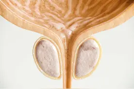 前列腺钙化是怎么引发的？有什么表现？怎么治疗？医生：一文讲清图片