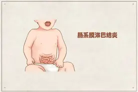 所有家长警惕！孩子肚子痛，可能是「肠系膜淋巴结炎 」惹的祸图片