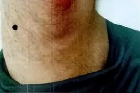 因“瞅你咋地”，男子殴打他人还持菜刀追逐，结果伤人伤己图片