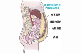 带你全面了解腹型肥胖！“大肚子”怎么减？图片