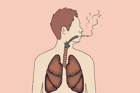 男子突发脑梗！每天狂吸40根烟，最后如何了？多少岁戒烟合适？图片