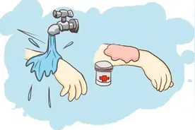 预防疤痕产生的黄金法则图片