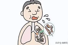 支气管发炎怎么办？这几个预防小妙招一定要牢记图片