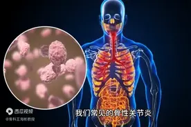 简单“热敷”就可以远离关节痛？这一情况，越热越严重图片