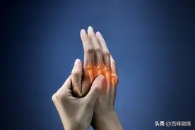 女子戴玉镯10年关节变形了：最后还是敲碎了图片