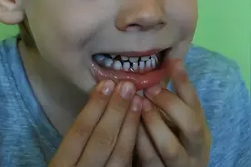 宝宝频繁流口水别忽视，可能在暗示你这几件事图片