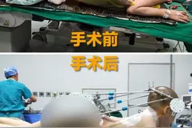 愿一切顺利！#00后折叠男孩首次手术完成图片